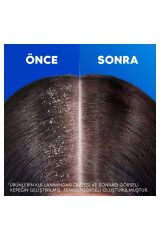 Head & Shoulders Şampuan 330 ml 1-1 Limon Ferahlığı